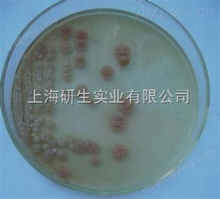 炭疽芽孢杆菌生长条件